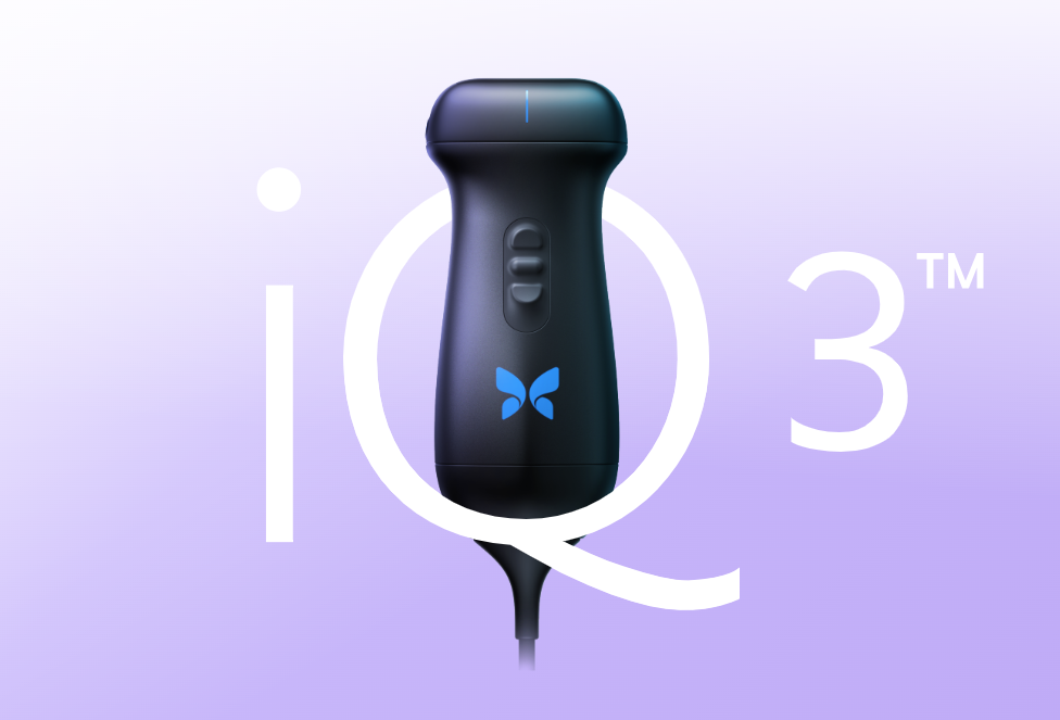 Butterfly iQ" portable ultrasound system